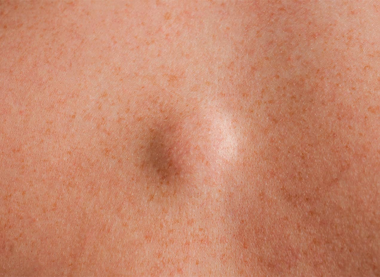 Image default